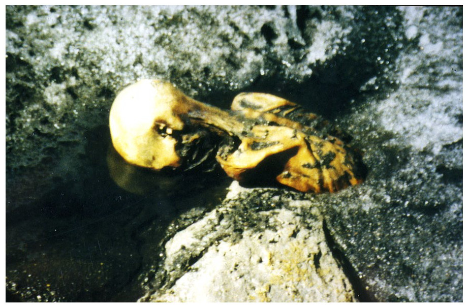 На фото: останки ледяного человека Эци