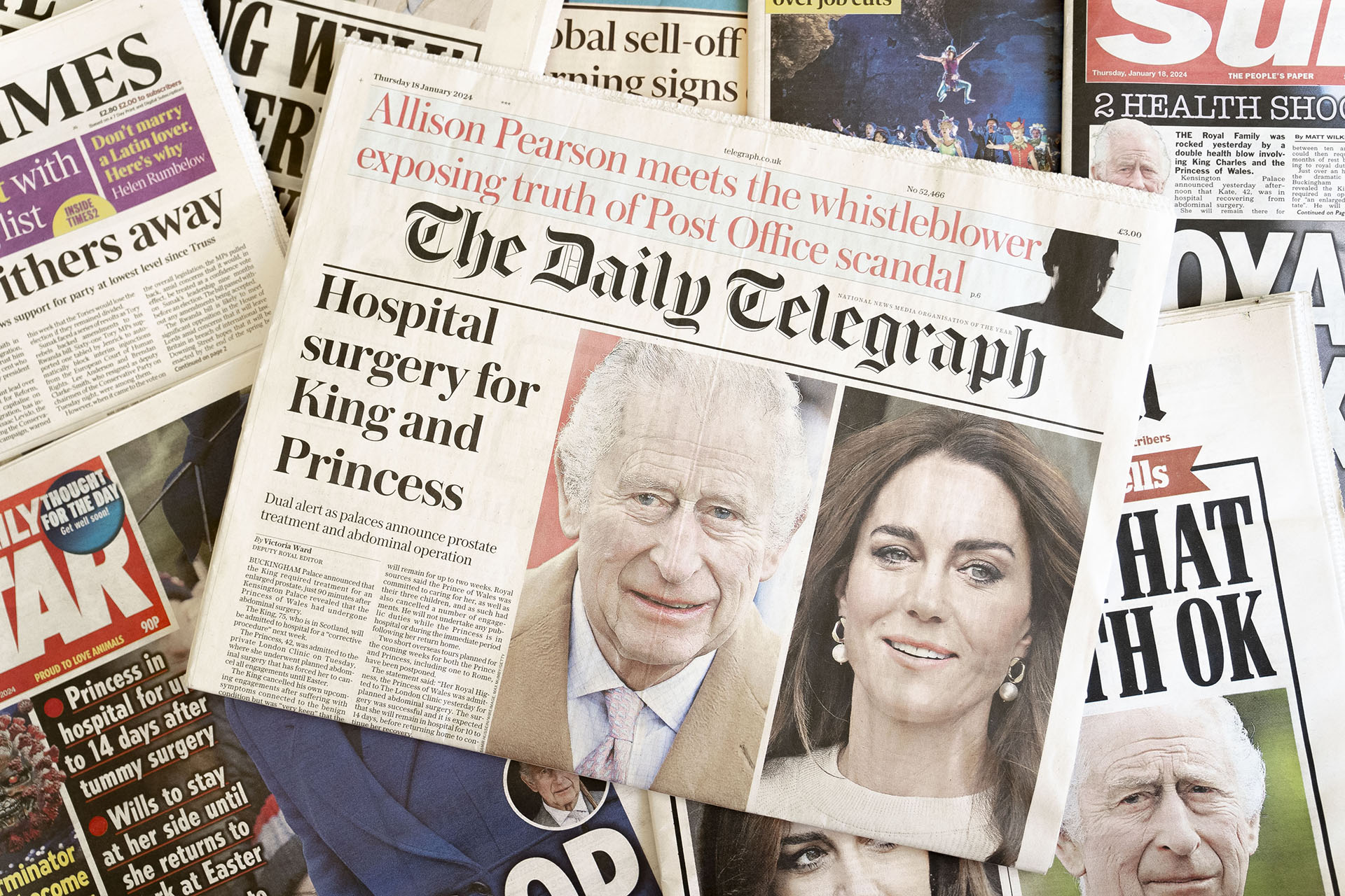 Первые полосы главных национальных газет Великобритании, освещающих госпитализацию Карла III и Кэтрин, принцессы Уэльской