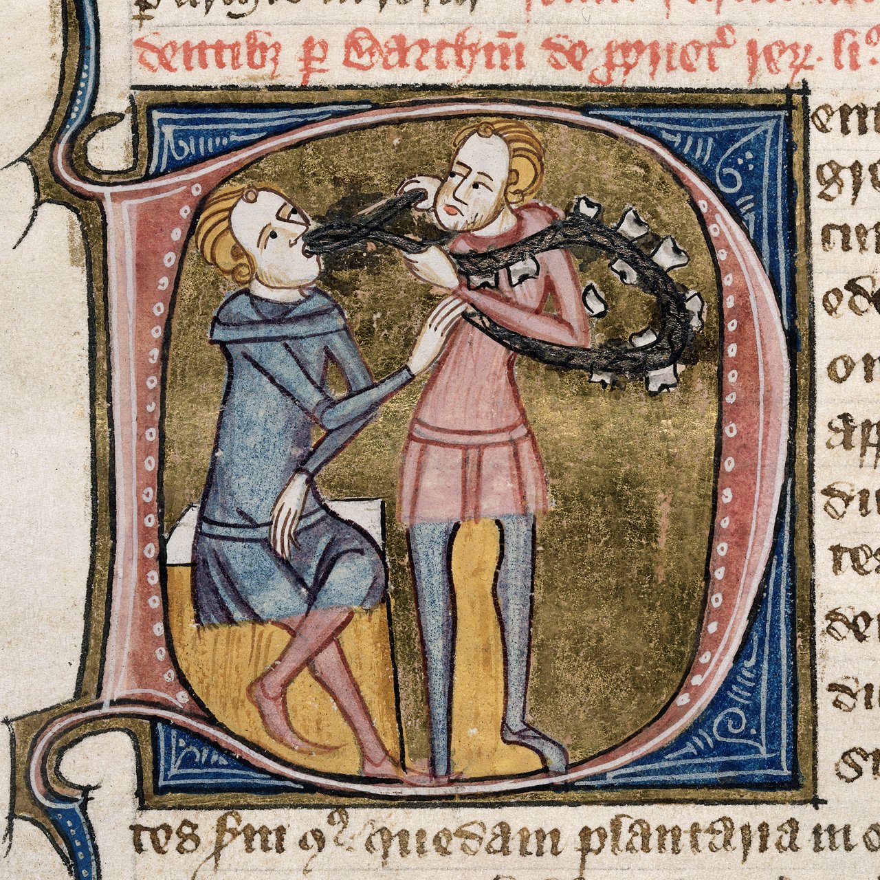 Удаление зубов. «Omne Bonum», Лондон (1360–1375)