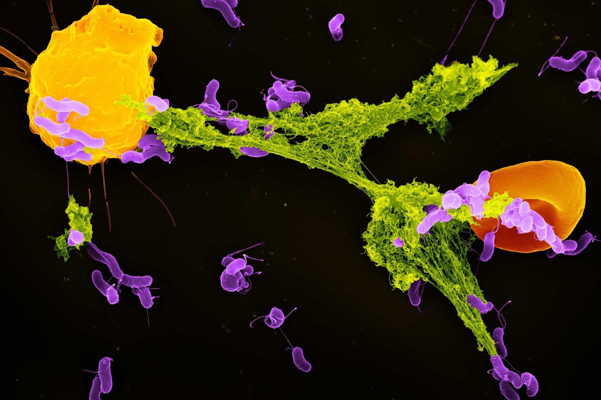 Бактерии (обозначены фиолетовым цветом), попавшие в сети-ловушки, построенные нейтрофилами и тромбоцитами